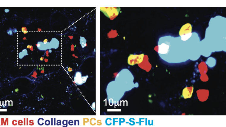 Confocal microscopy of a lung section, 4 days after being rechallenged with an influenza virus. Resident memory B cells (red) and newly generated plasma cells (yellow) can be seen in very close proximity to infected cells (light blue).
