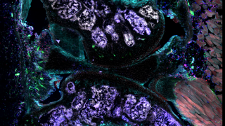 Confocal imaging of antigen-induced arthritis in mouse knee. Image taken by Kristina Zec