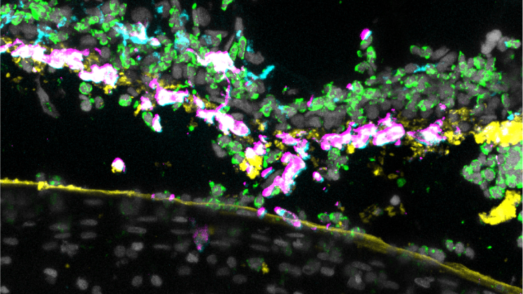 fluorescence-stained cells in the synovial lining